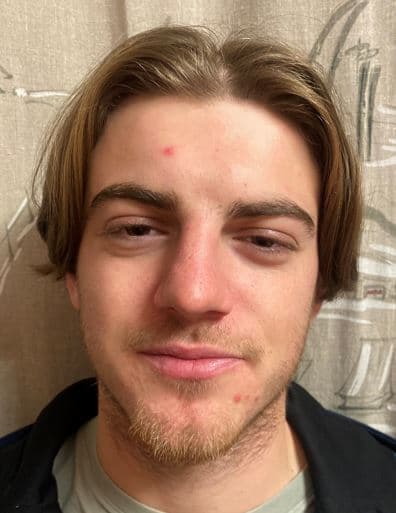 ENZO GRAS